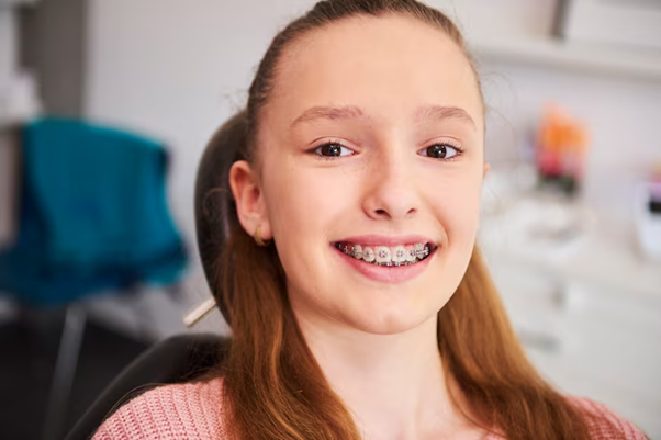 Affordable Dental Braces in Dubai: Everything You Need to Know Before Treatment