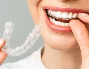 Aligners for Adults: Achieve a Straighter Smile at Any Age