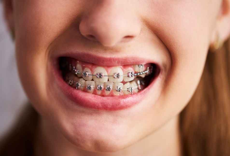 orthodontic clinic in ajman: orthodontist in ajman