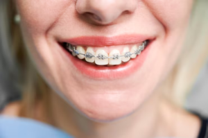 Orthodontist vs. General Dentist: What’s the Difference?