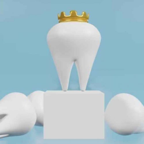 Dental Crowns in Ajman