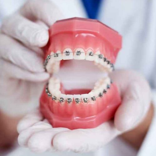 orthodontic clinic in ajman: orthodontist in ajman