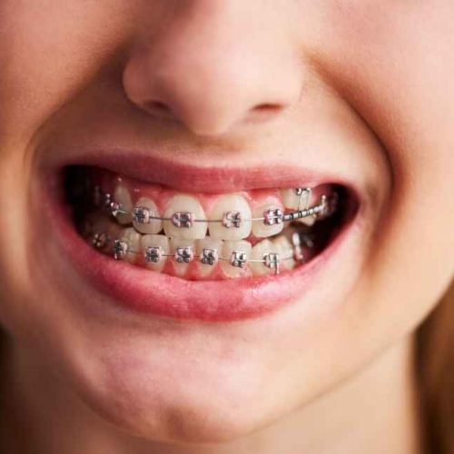 orthodontic clinic in ajman: orthodontist in ajman